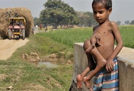 کودک هشت دست و پای هندی + عکس