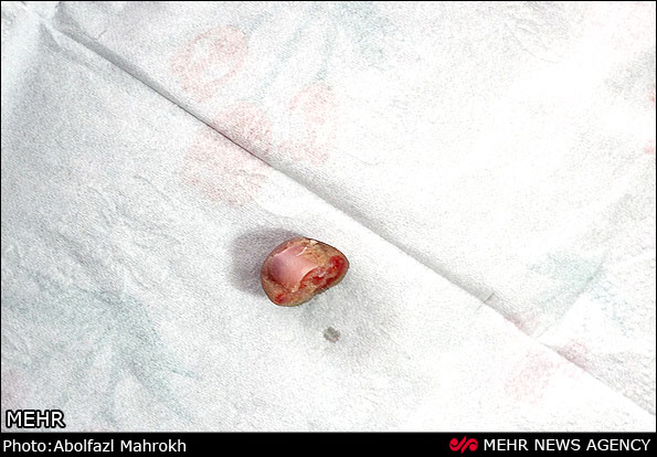 http://www.jahannews.com/images/docs/000250/n00250592-r-b-005.jpg